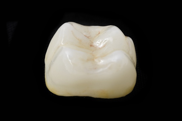 What To Do After Damaging A Dental Crown