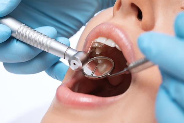 Types Of Dental Fillings By A General Dentist