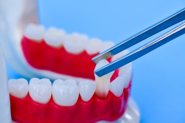 How To Know If You&#    ;re A Candidate For Dental Implants