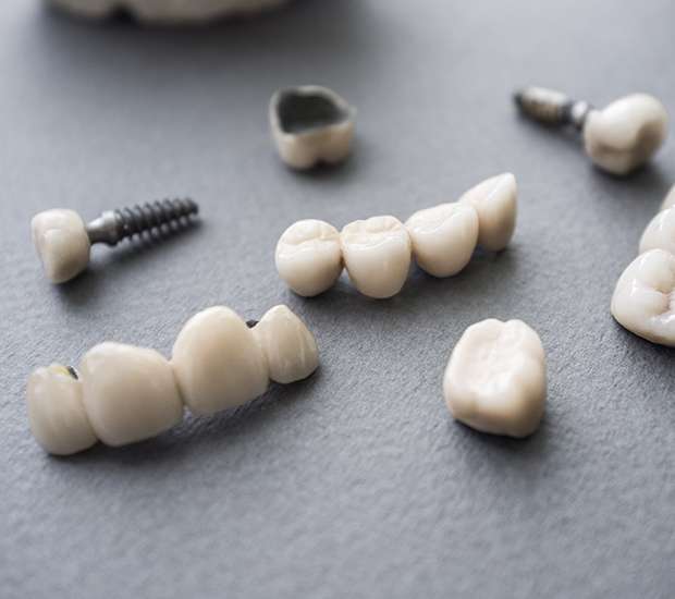 Fredericksburg The Difference Between Dental Implants and Mini Dental Implants