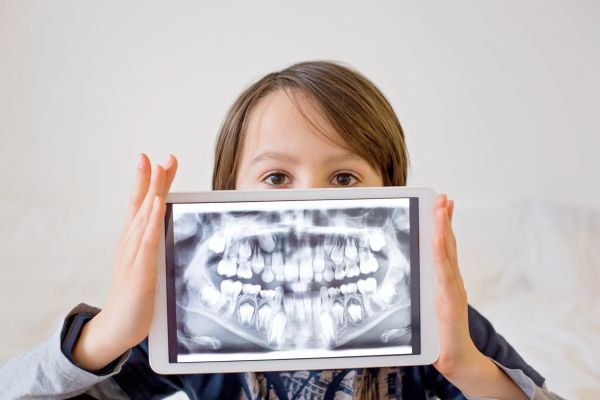 How Does A Kid Friendly Dentist Use X Rays?