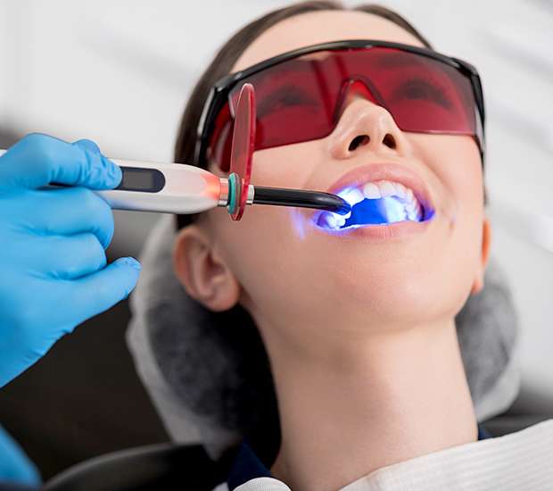 Fredericksburg Professional Teeth Whitening